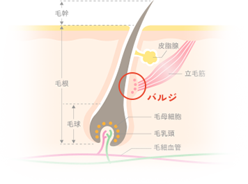 バルジ領域にアプローチできる脱毛器